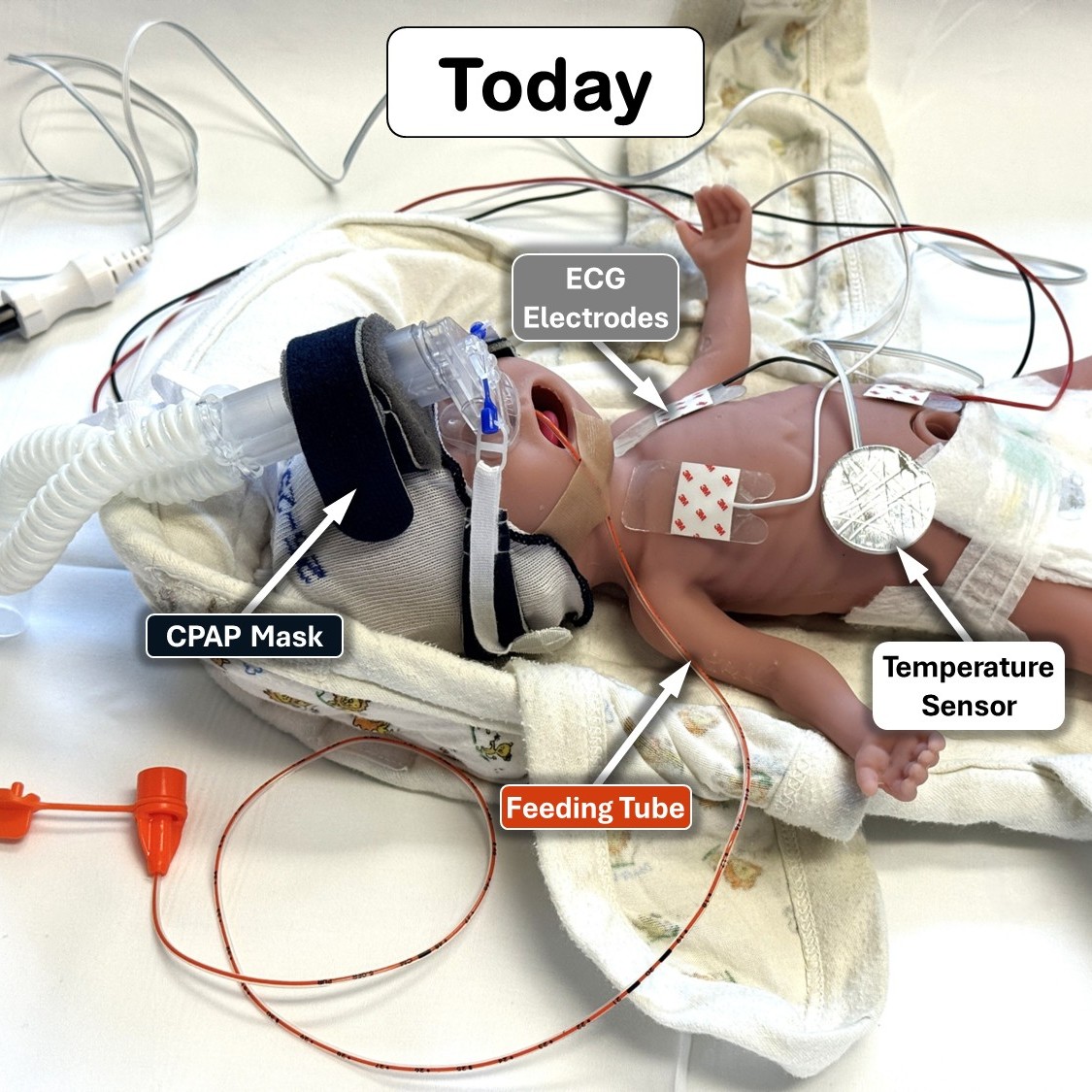 1.1-Before with CPAP-W Annotation